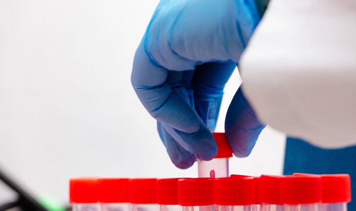 UAB Department of Pathology's Fungal Reference Laboratory conducts COVID-19 research | Photo: UAB Image Gallery